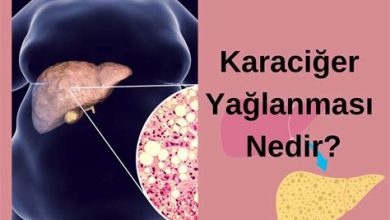 Karaciğer Yağlanması Belirtileri Nelerdir?